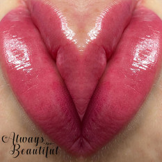 Candy Lips