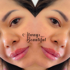 Candy Lips
