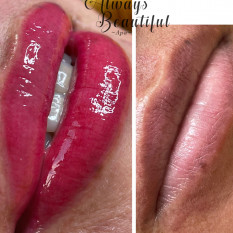 Candy Lips